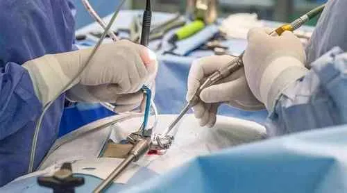 Лапароскопическая операция на грыже пупка: Герниопластика